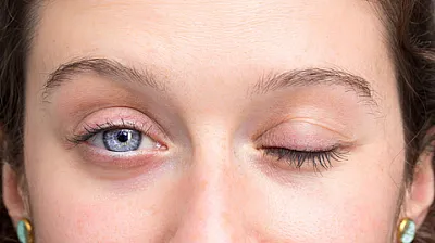 Yüz Felcinde Soğuk Hava Masum mu?