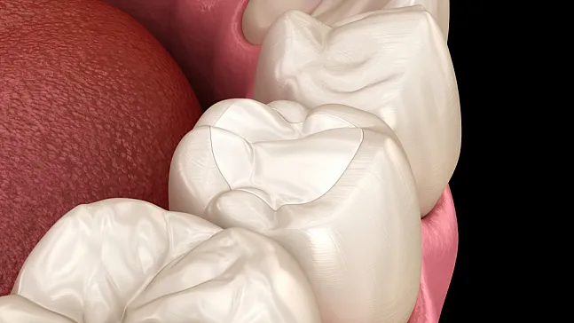 Estetik Dolguların Ömrünü Alışkanlıklarımız Belirliyor